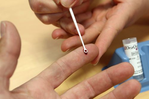 Padres deben estar atentos a síntomas de hepatitis en menores de 16&nbsp;años