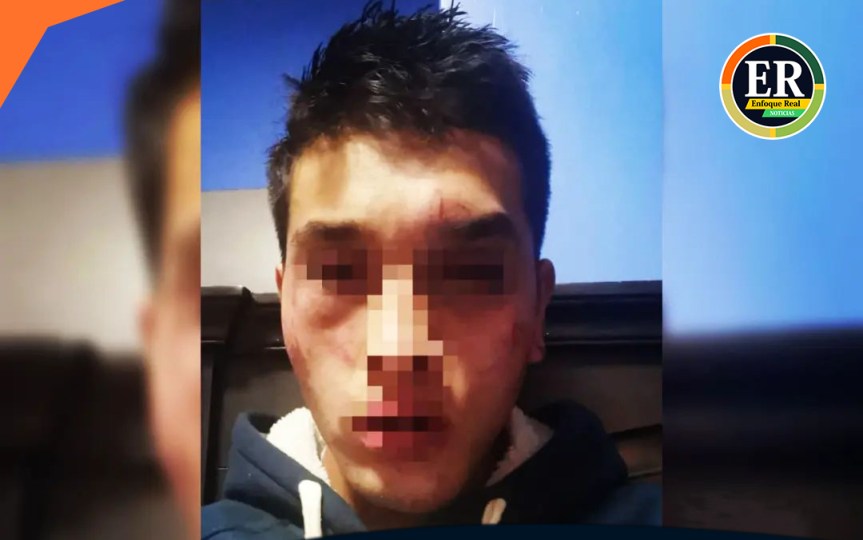 Denuncian agresión de joven en discoteca&nbsp;Pakatnamu