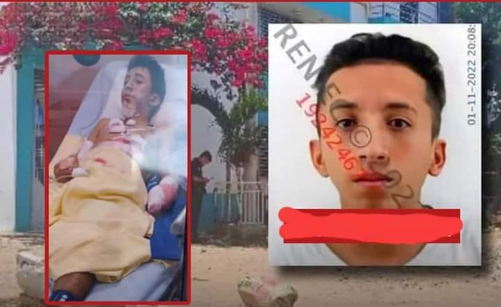 Cajamarca: Extorsionador que perdió parte del brazo por explosivo fue recluido en&nbsp;penal