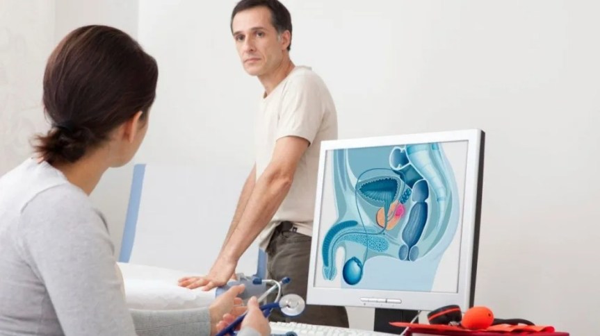 Hiperplasia benigna de próstata: el tumor más frecuente en&nbsp;varones