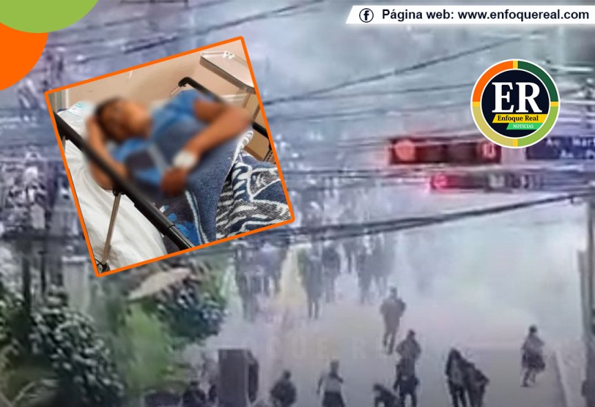 Niño de 13 años no puede caminar tras recibir balazo en la columna durante protestas en&nbsp;Andahuaylas