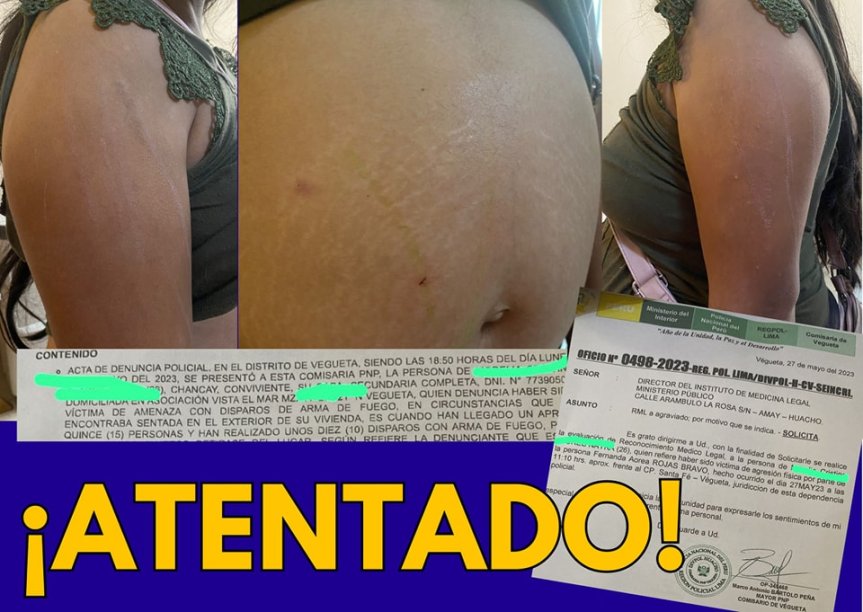 Végueta: mujer embarazada fue agredida por desadaptados que pudieron haberle causado una&nbsp;desgracia