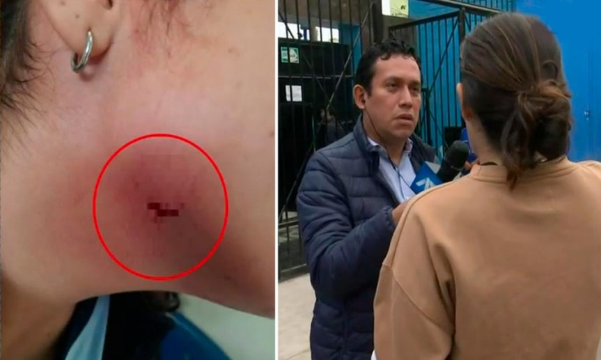 Callao: Escolar le corta el cuello a su compañera con un&nbsp;cutter