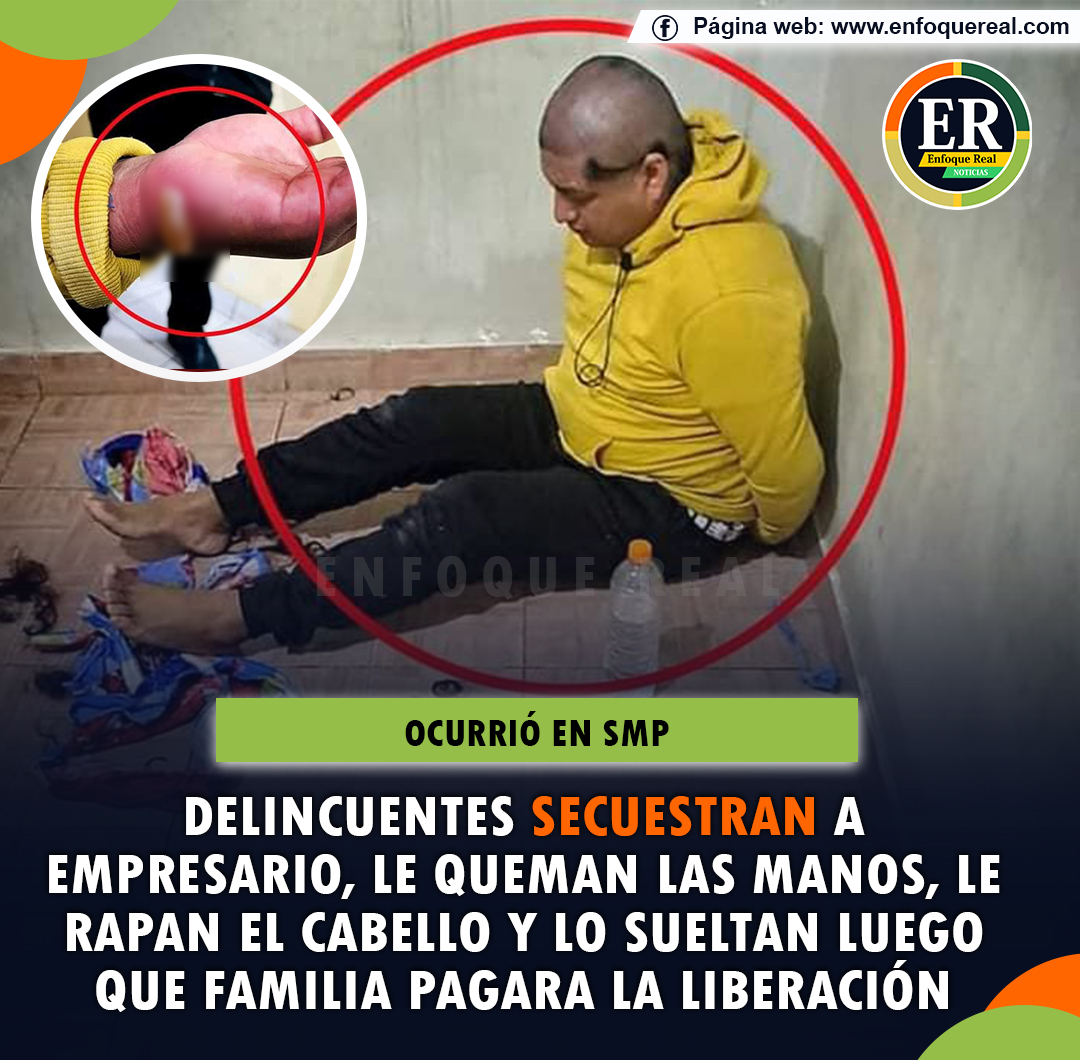 Delincuentes secuestran a empresario, le queman las manos, le rapan el
