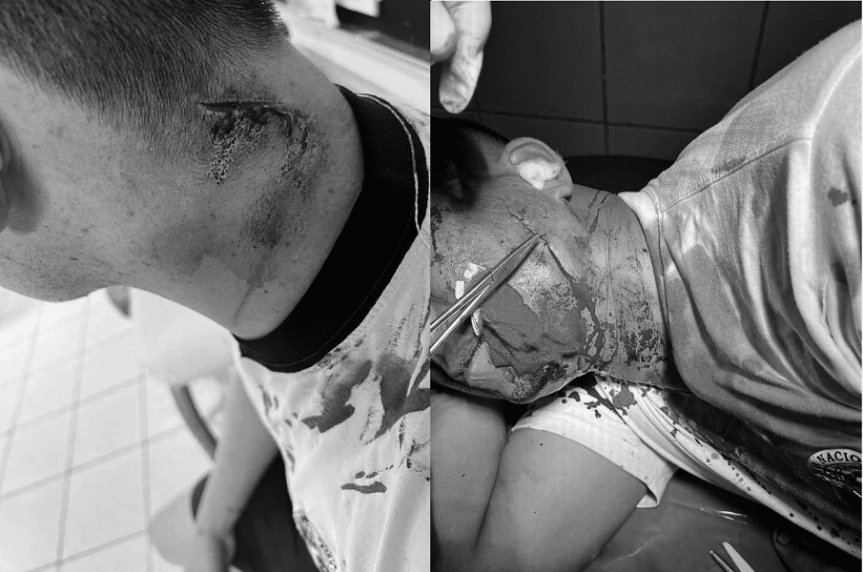 Fiscalía de Barranca libera a sujetos que intentaron matar a policías: Mininter anuncia&nbsp;medidas