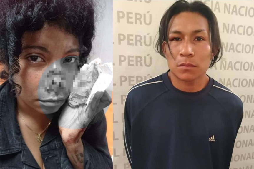 Hombre arr4nca parte de su nariz a su expareja con una mordida en el&nbsp;Callao