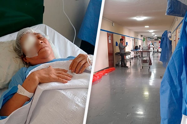 Escándalo en EsSalud: extirpan los ojos a tres personas por&nbsp;virus