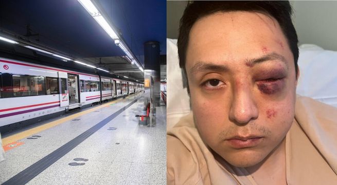 Peruano casi pierde un ojo tras brutal agre**sión racis**ta en España: esto se&nbsp;sabe