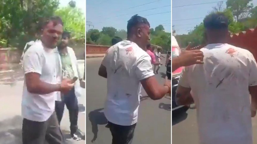 Así salió caminando el único sobreviviente del avión de Air India que se estrelló con 242 personas a&nbsp;bordo