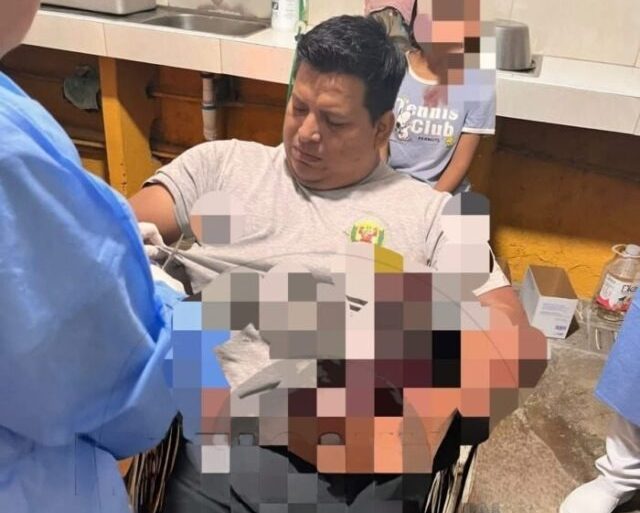 Iquitos: Policía mur**ió tras ser acuchi**llado durante una intervención por violencia&nbsp;familiar